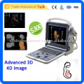 MSLCU28I vascular doppler ultrasound machine & 3d 4d color doppler ultrasound